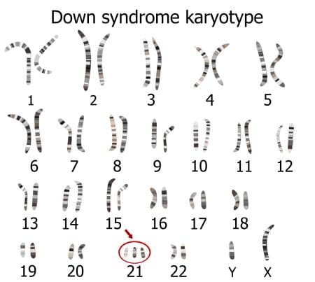 Karyotype Analysis and Chromosome Abnormalities